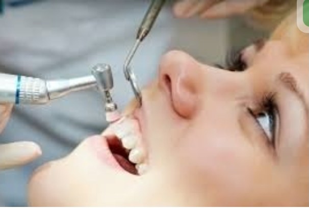 Procedimiento de limpieza dental