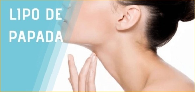 Imagen relacionada con lipo de papada