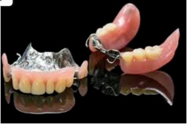Prótesis dental removible